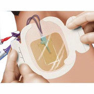 3M 1657 Tegaderm CHG Chlorhexidine Gluconate IV Securement Dressing SIZE 8.5CM X 11.5CM, BX/25